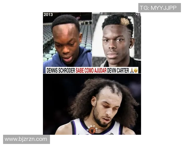 网友晒施罗德发际线逆生长对比图调侃德文卡特让人忍俊不禁